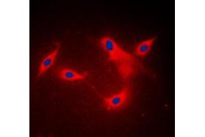 Immunofluorescent analysis of LYPLA1 staining in MDAMB453 cells. (LYPLA1 antibody  (Center))