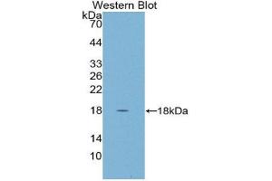 Western Blotting (WB) image for anti-Cystatin D (CST5) (AA 21-142) antibody (ABIN1867419) (CST5 antibody  (AA 21-142))