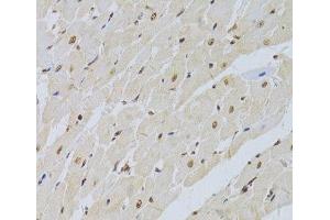 Immunohistochemistry of paraffin-embedded Rat heart using SNRPA Polyclonal Antibody at dilution of 1:100 (40x lens). (SNRPA1 antibody)