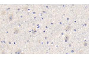 Detection of CYPA in Human Cerebrum Tissue using Polyclonal Antibody to Cyclophilin A (CYPA) (PPIA antibody  (AA 2-165))