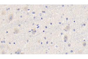 Detection of CYPA in Human Cerebrum Tissue using Polyclonal Antibody to Cyclophilin A (CYPA) (PPIA antibody  (AA 2-165))