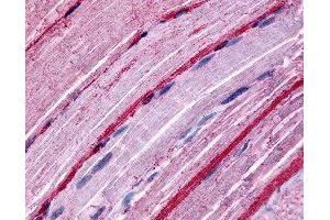 Immunohistochemical (Formalin/PFA-fixed paraffin-embedded sections) staining in human myocytes with GRK5 polyclonal antibody . (GRK5 antibody)