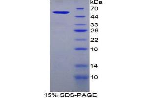 SDS-PAGE (SDS) image for Filaggrin (FLG) (AA 119-336) protein (His tag,GST tag) (ABIN2122871)