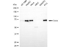 Western blotting analysis using coilin antibody (ABIN7798119). (Recombinant Coilin antibody)
