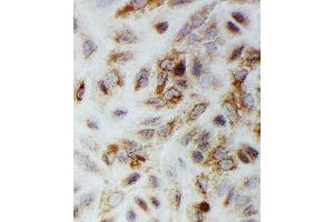 Anti-Smad1 antibody, ICC ICC: A549 Cell (SMAD1 antibody  (C-Term))