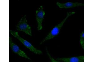 SH-SY-5Y cells were stained with TrkB(Y817) (2A1 ) Monoclonal Antibody  at [1:200] incubated overnight at 4C, followed by secondary antibody incubation, DAPI staining of the nuclei and detection. (TRKB antibody  (pTyr817))