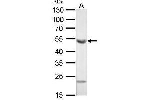 WB Image ALDH1A1 antibody [C3], C-term detects ALDH1A1 protein by Western blot analysis.