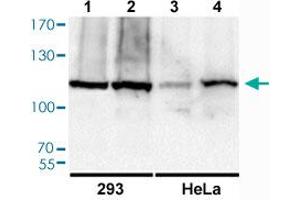 Western blot analysis of Lane 1: Untreated 293 cells, Lane 2: Insulin treated 293 cells, Lane 3: Untreated HeLa cells, Lane 4: UV treated HeLa cells with RB1 (phospho S811) polyclonal antibody  at 1:500-1:2000 dilution. (Retinoblastoma 1 antibody  (pSer811))
