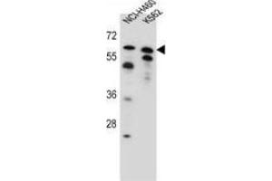 Western blot analysis in NCI-H460, K562 cell line lysates (35ug/lane) using PLAG1  Antibody (N-term). (PLAG1 antibody  (N-Term))