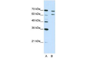 CPSF3 antibody used at 5 ug/ml to detect target protein. (CPSF3 antibody  (N-Term))