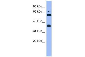 CYP2B6 antibody used at 1 ug/ml to detect target protein.