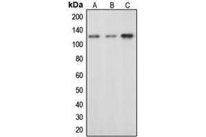 Western blot analysis of c-CBL (pY674) expression in HeLa EGF-treated (A), mouse liver (B), rat liver (C) whole cell lysates.