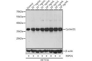 Western blot analysis of extracts of HCT116 cells using Cyclin D1 Polyclonal Antibody at dilution of 1:1000. (Cyclin D1 antibody)