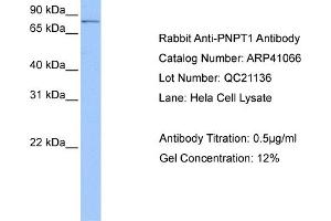 Western Blotting (WB) image for anti-Polyribonucleotide Nucleotidyltransferase 1 (PNPT1) (Middle Region) antibody (ABIN2776602) (PNPT1 antibody  (Middle Region))