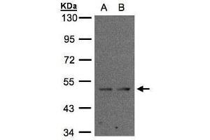 WB Image Sample(30 ug whole cell lysate) A:MOLT4 , B:Raji , 10% SDS PAGE antibody diluted at 1:2000 (IFRD1 antibody)