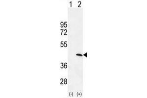 Western blot analysis of PRKAG1 (arrow) using rabbit polyclonal PRKAG1 Antibody (N-term) .