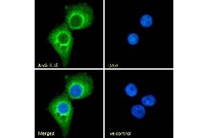 (ABIN570987) Immunofluorescence analysis of paraformaldehyde fixed A431 cells, permeabilized with 0. (IL-18 antibody  (Internal Region))