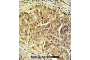 Immunohistochemistry (IHC) image for anti-Cell Division Cycle 45 Homolog (S. Cerevisiae) (CDC45) antibody (ABIN3004359)