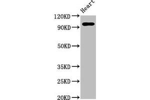 Western Blot Positive WB detected in: Rat heart tissue All lanes: GRM2 antibody at 5 μg/mL Secondary Goat polyclonal to rabbit IgG at 1/50000 dilution Predicted band size: 96 kDa Observed band size: 96 kDa (GRM2 antibody  (AA 93-221))