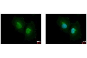 ICC/IF Image ASL antibody detects ASL protein at cytoplasm and nucleus by immunofluorescent analysis.