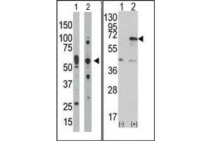 Image no. 1 for anti-Eukaryotic Translation Initiation Factor 2-alpha Kinase 2 (EIF2AK2) (C-Term) antibody (ABIN360664) (EIF2AK2 antibody  (C-Term))