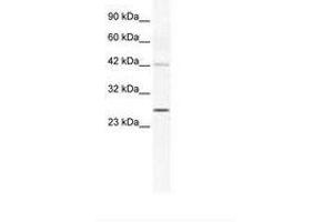 Image no. 1 for anti-Gap Junction Protein, beta 4, 30.3kDa (GJB4) (AA 86-135) antibody (ABIN202138)