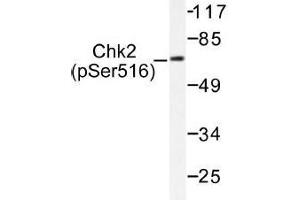 Image no. 1 for anti-Checkpoint Kinase 2 (CHEK2) (pSer516) antibody (ABIN317990) (CHEK2 antibody  (pSer516))
