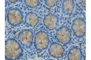 Detection of TFF3 in Human Intestine Tissue using Polyclonal Antibody to Trefoil Factor 3 (TFF3) (TFF3 antibody  (AA 22-80))