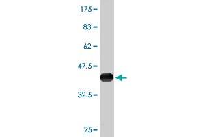 Western Blot detection against Immunogen (36. (NDRG2 antibody  (AA 1-96))