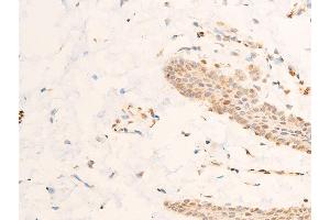 ABIN6267218 at 1/100 staining human skin tissue sections by IHC-P.