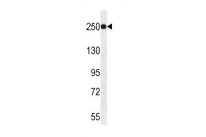 JARID1A Antibody (C-term) (ABIN656192 and ABIN2843346) western blot analysis in uterus tumor cell line lysates (35 μg/lane). (KDM5A antibody  (C-Term))