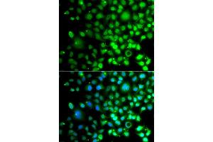 Immunofluorescence analysis of A549 cell using SMAD9 antibody.
