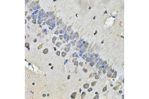 Immunohistochemistry of paraffin-embedded rat brain using MYH1 Antibody (ABIN5974170) at dilution of 1/100 (40x lens). (MYH1 antibody)