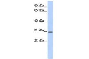 Image no. 1 for anti-Breast Carcinoma Amplified Sequence 2 (BCAS2) (N-Term) antibody (ABIN6740687) (BCAS2 antibody  (N-Term))