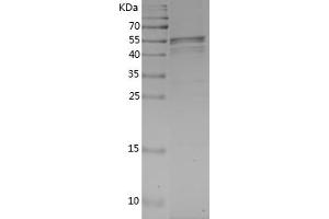 Western Blotting (WB) image for Interleukin-1 Receptor-Associated Kinase 4 (IRAK4) (AA 1-196) protein (GST tag) (ABIN7281763) (IRAK4 Protein (AA 1-196) (GST tag))