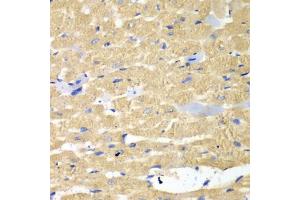 Immunohistochemistry of paraffin-embedded mouse heart using HAX1 antibody (ABIN5973233) at dilution of 1/100 (40x lens). (HAX1 antibody)