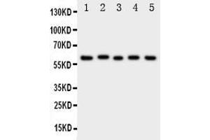 Western blot analysis of ASIC3 using anti- ASIC3 antibody . (ASIC3 antibody  (N-Term))