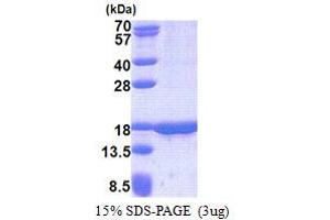 SDS-PAGE (SDS) image for Tumor Suppressor Candidate 2 (TUSC2) (AA 1-110) protein (His tag) (ABIN5853200)