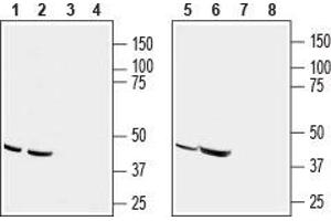 Western blot analysis of human acute T cell leukemia (Jurkat) (lanes 1 and 3), human melanoma (MALME-3M) (lanes 2 and 4), human adenocarcinoma (HT-29) (lanes 5 and 7) and mouse T-cell lymphoma (TK-1) (lanes 6 and 8) cell line lysates: - 1,2,5,6. (CCR9 antibody  (Extracellular))