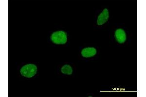 Immunofluorescence of purified MaxPab antibody to APEX2 on HeLa cell.