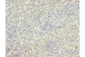 Immunohistochemistry of paraffin-embedded human spleen tissue using ABIN7171726 at dilution of 1:100 (ZBTB48 antibody  (AA 1-280))