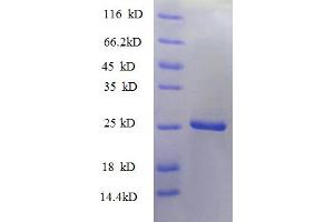 SDS-PAGE (SDS) image for Tumor Necrosis Factor Receptor Superfamily, Member 9 (TNFRSF9) (AA 52-254), (partial) protein (His tag) (ABIN5712556)