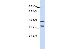 WB Suggested Anti-ZNF177 Antibody Titration:  0. (ZNF177 antibody  (Middle Region))