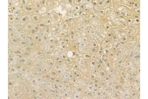ABIN6264972 and ABIN6276622 at 1/100 staining human normal liver tissue by IHC-P.