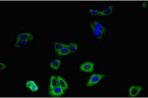 Immunofluorescent analysis of HepG2 cells using ABIN7176688 at dilution of 1:100 and Alexa Fluor 488-congugated AffiniPure Goat Anti-Rabbit IgG(H+L) (SLC3A8 (AA 320-369) antibody)