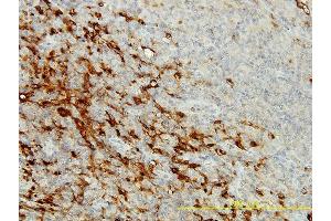 Immunoperoxidase of monoclonal antibody to CPVL on formalin-fixed paraffin-embedded human lymphomar tissue. (CPVL antibody  (AA 1-476))