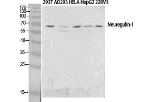 Western Blotting (WB) image for anti-Neuregulin 1 (NRG1) (N-Term) antibody (ABIN3187835) (Neuregulin 1 antibody  (N-Term))
