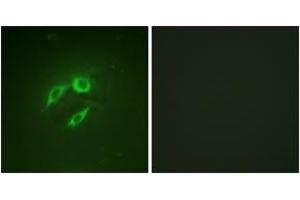 Immunofluorescence analysis of A549 cells, using SEK1/MKK4/JNKK1 (Ab-257) Antibody.