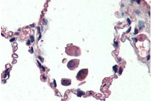 Human Lung (formalin-fixed, paraffin-embedded) stained with UCP2 antibody ABIN461943 at 3. (UCP2 antibody  (AA 101-113))