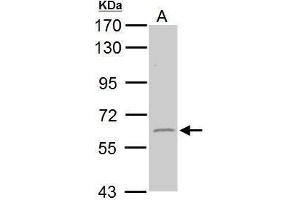 WB Image Sample (50 ug of whole cell lysate) A: mouse brain 7. (GAD65 antibody  (C-Term))